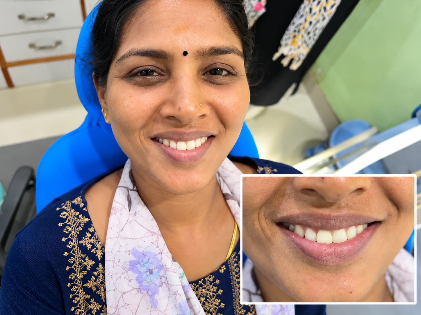 Dental smile transformation after treatment