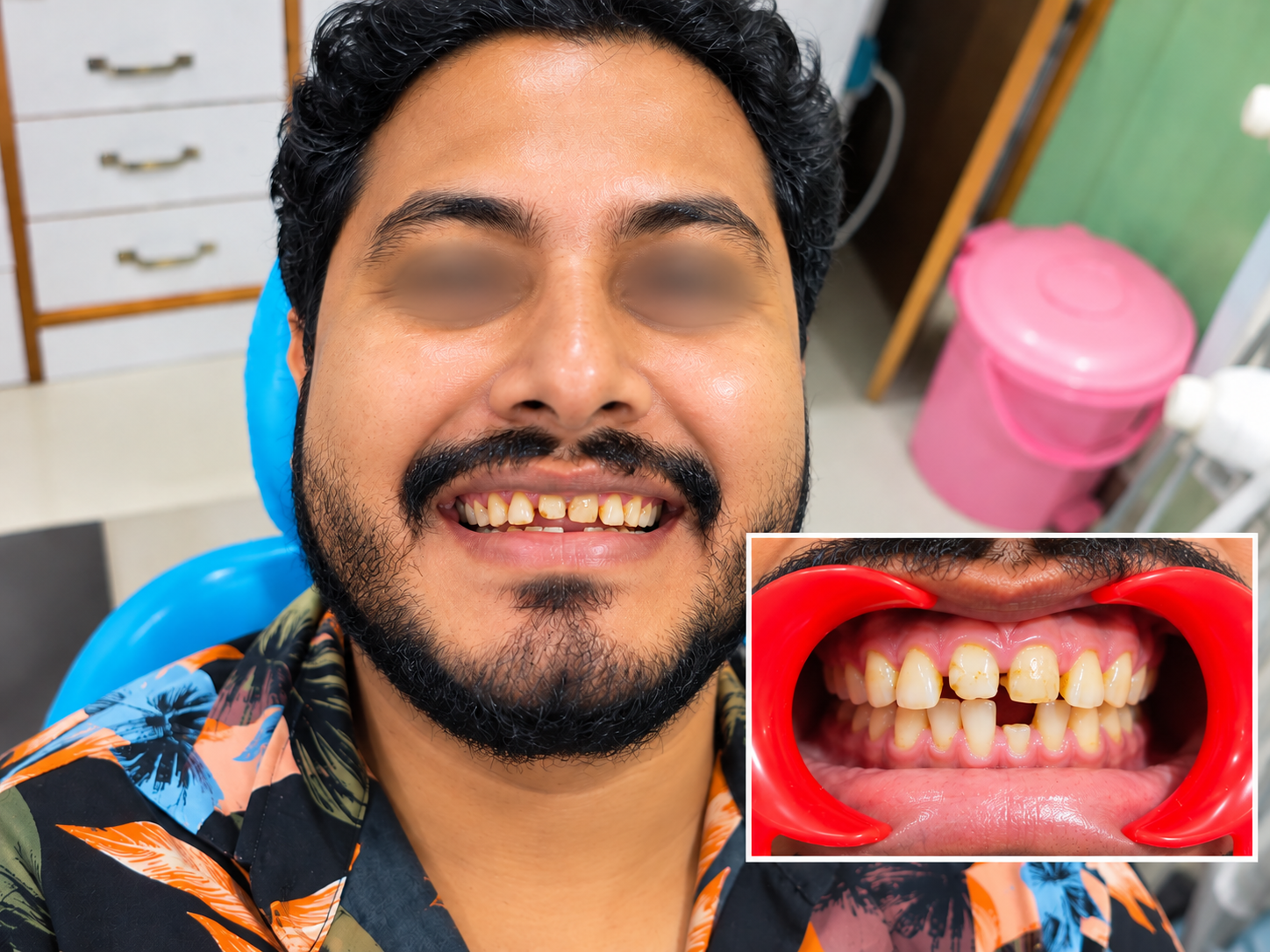 Dental smile transformation before treatment